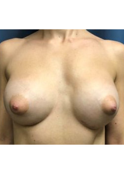 After Image