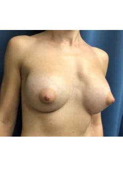 After Image