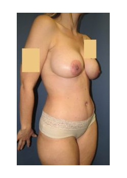 After Image