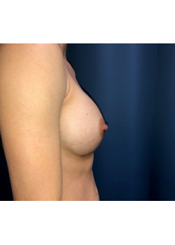 After Image