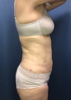 After Image