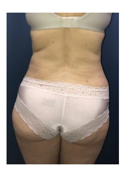 After Image