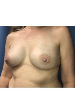 After Image
