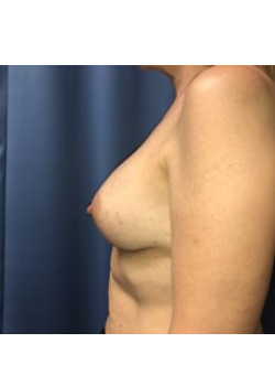 After Image