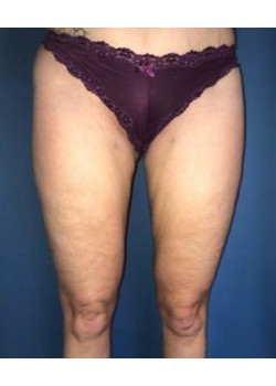 After Image