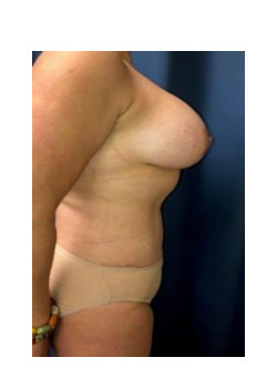After Image