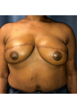 After Image