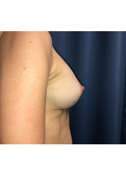After Image