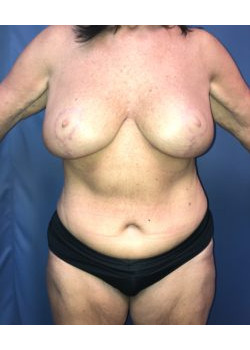 After Image