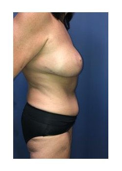 After Image