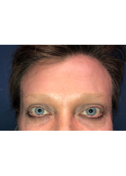After Image