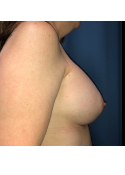 After Image