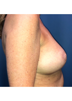After Image