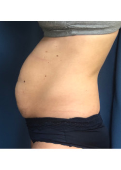 Before Image