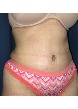 After Image