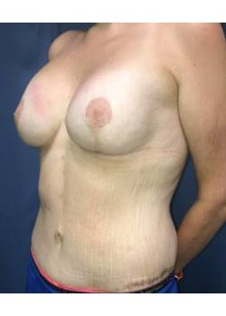 After Image