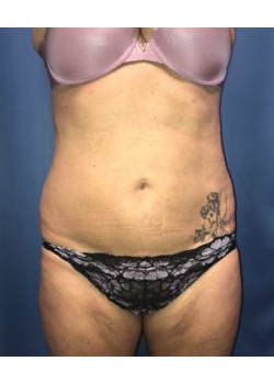 After Image