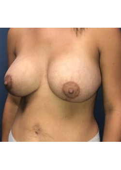 After Image