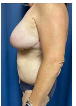 After Image