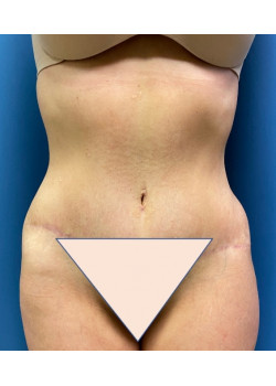 After Image