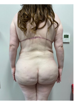 After Image