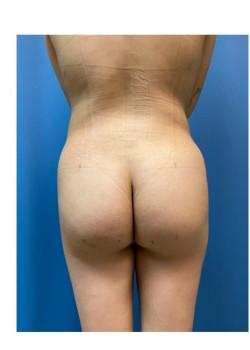 After Image