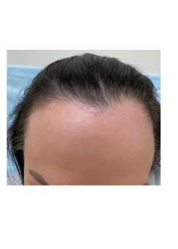 Before Image