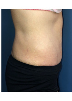 After Image