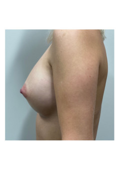 After Image