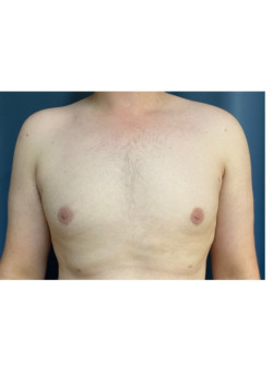 After Image