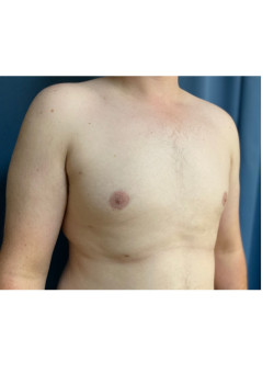 After Image