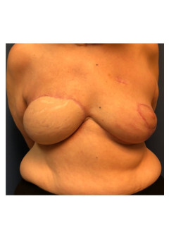 After Image