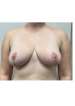 After Image
