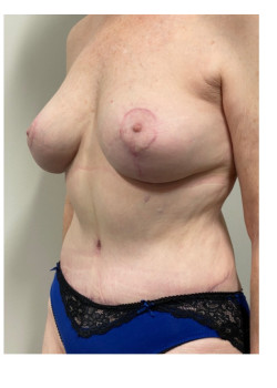 After Image