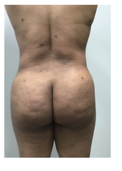 After Image