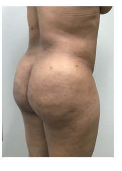 After Image