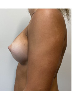 After Image
