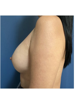 After Image