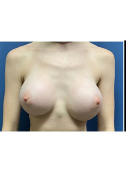 After Image