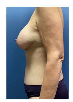 After Image