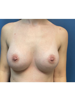 After Image