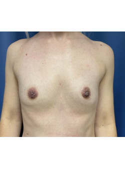 Before Image