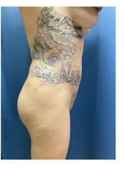 After Image