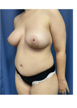 After Image
