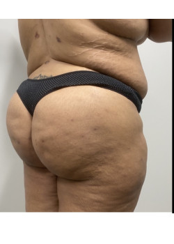 After Image
