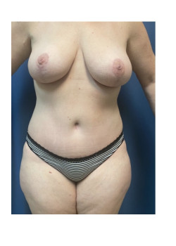After Image