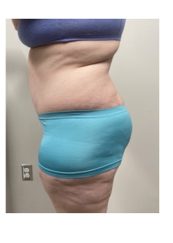 After Image