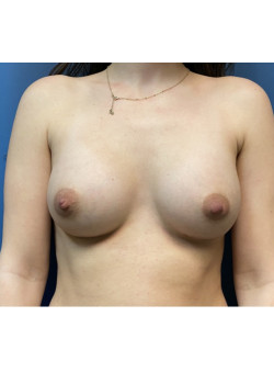 After Image