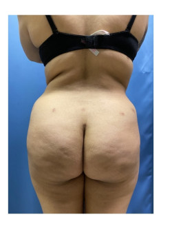 After Image