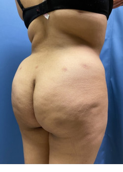 After Image